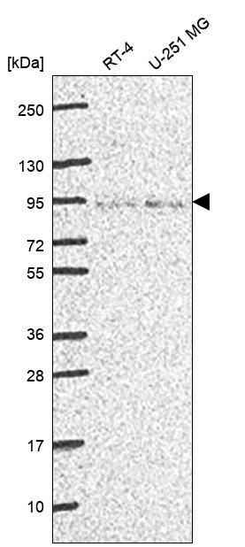 FoxP4 Antibody Western Blot: FoxP4 Antibody [NBP3-24854]