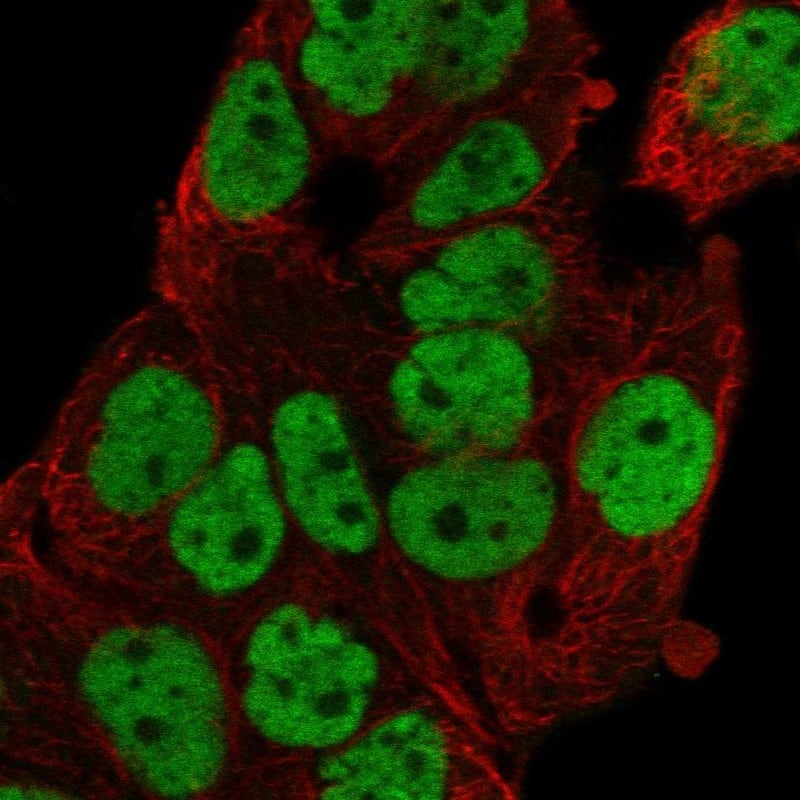 FoxP4 Antibody Immunocytochemistry/Immunofluorescence: FoxP4 Antibody [NBP3-24854]