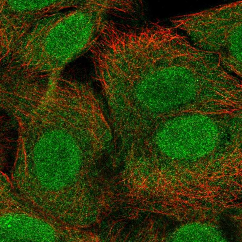 FOXR1 Antibody Immunocytochemistry/Immunofluorescence: FOXR1 Antibody [NBP3-24855]