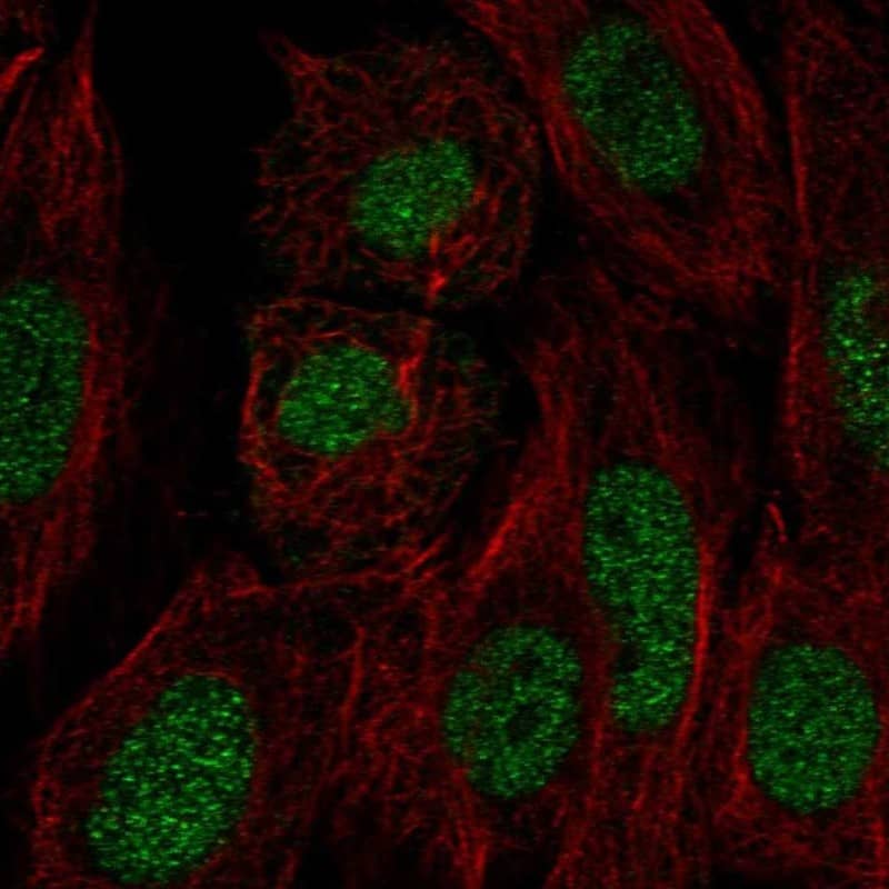 Fructosamine-3-kinase-related Antibody Immunocytochemistry/Immunofluorescence: Fructosamine-3-kinase-related Antibody [NBP3-24856]