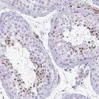 TSBP Antibody Immunohistochemistry-Paraffin: TSBP Antibody [NBP3-24858]