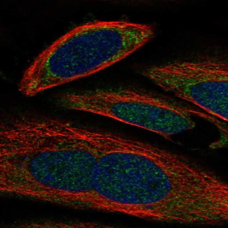 GALE Antibody Immunocytochemistry/Immunofluorescence: GALE Antibody [NBP3-24859]