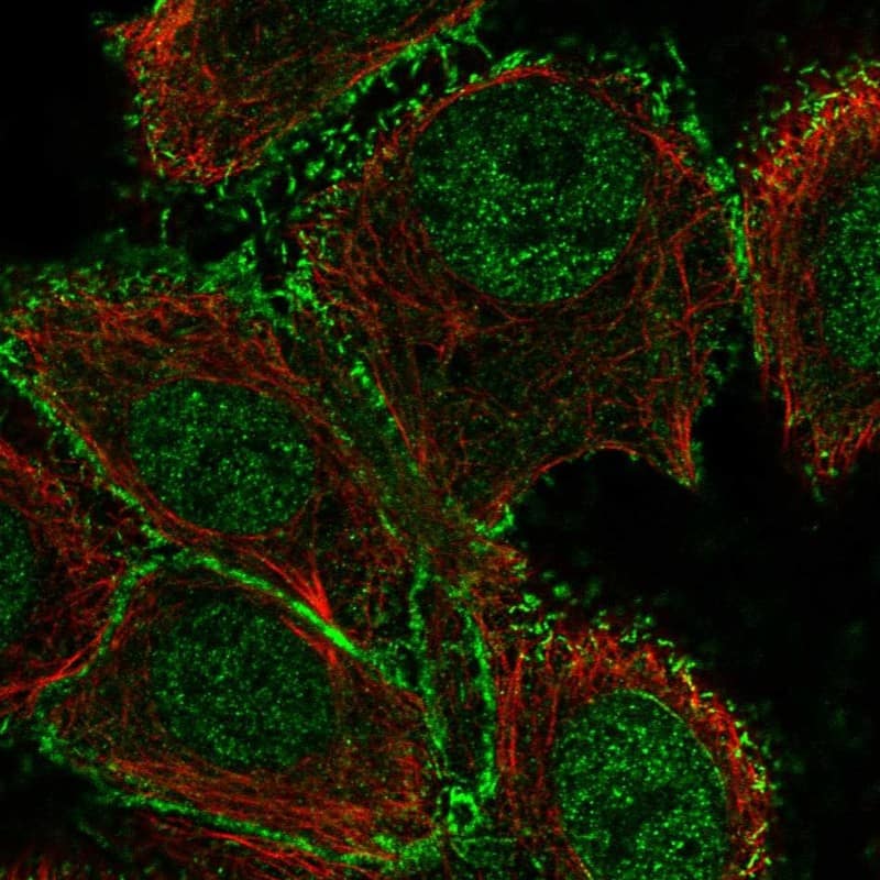 GALNT12 Antibody Immunocytochemistry/Immunofluorescence: GALNT12 Antibody [NBP3-24860]