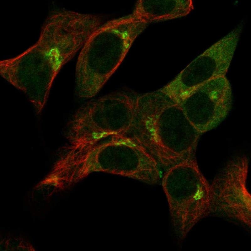 Gamma Adaptin Antibody Immunocytochemistry/Immunofluorescence: Gamma Adaptin Antibody [NBP3-24861]