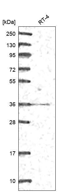 GGPS1 Antibody Western Blot: GGPS1 Antibody [NBP3-24866]