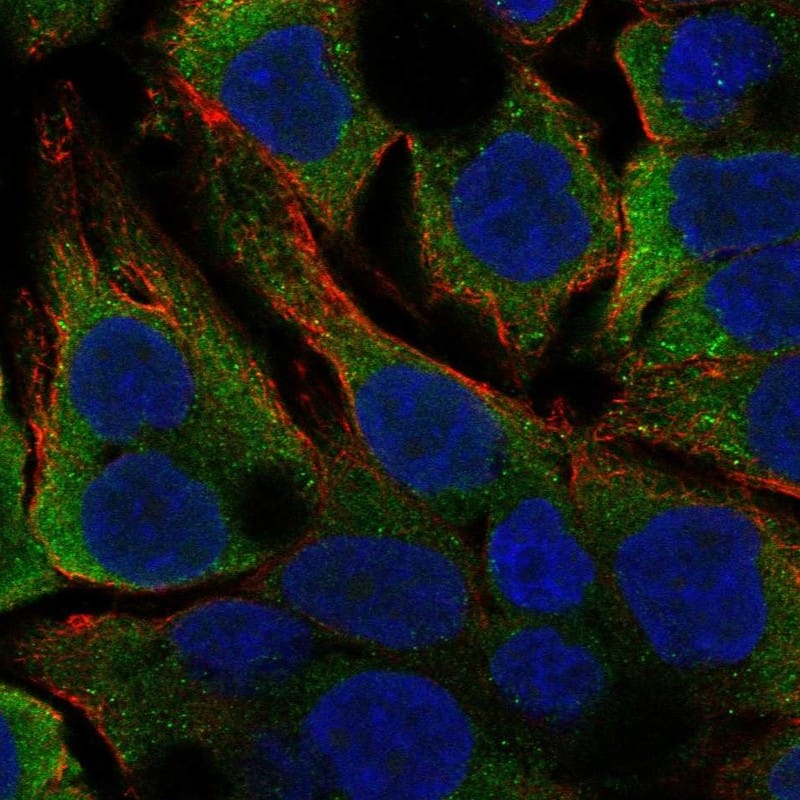 GGPS1 Antibody Immunocytochemistry/Immunofluorescence: GGPS1 Antibody [NBP3-24866]