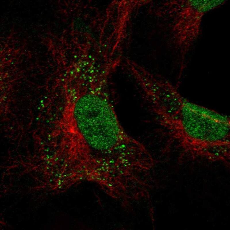 GIMAP2 Antibody Immunocytochemistry/Immunofluorescence: GIMAP2 Antibody [NBP3-24867]