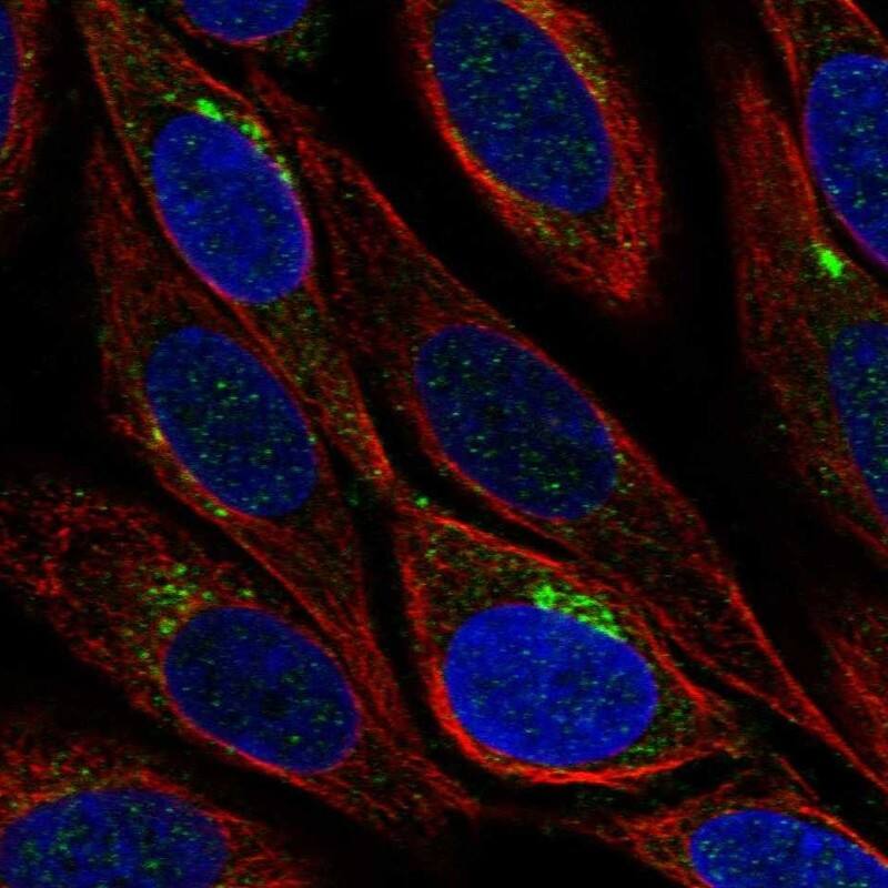 GLT8D1 Antibody Immunocytochemistry/Immunofluorescence: GLT8D1 Antibody [NBP3-24869]