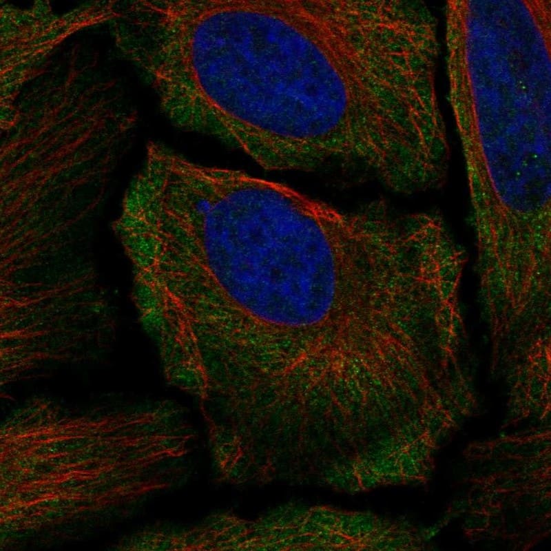 GluR5/GRIK1 Antibody Immunocytochemistry/Immunofluorescence: GluR5/GRIK1 Antibody [NBP3-24871]