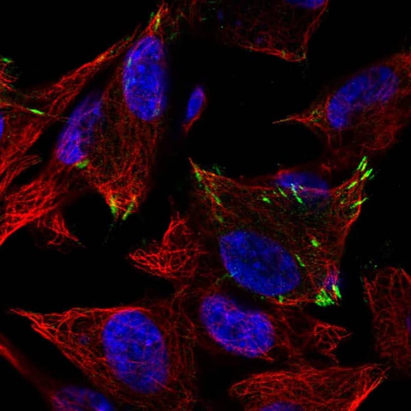 Glutamate Receptor 4 Antibody Immunocytochemistry/Immunofluorescence: Glutamate Receptor 4 Antibody [NBP3-24873]