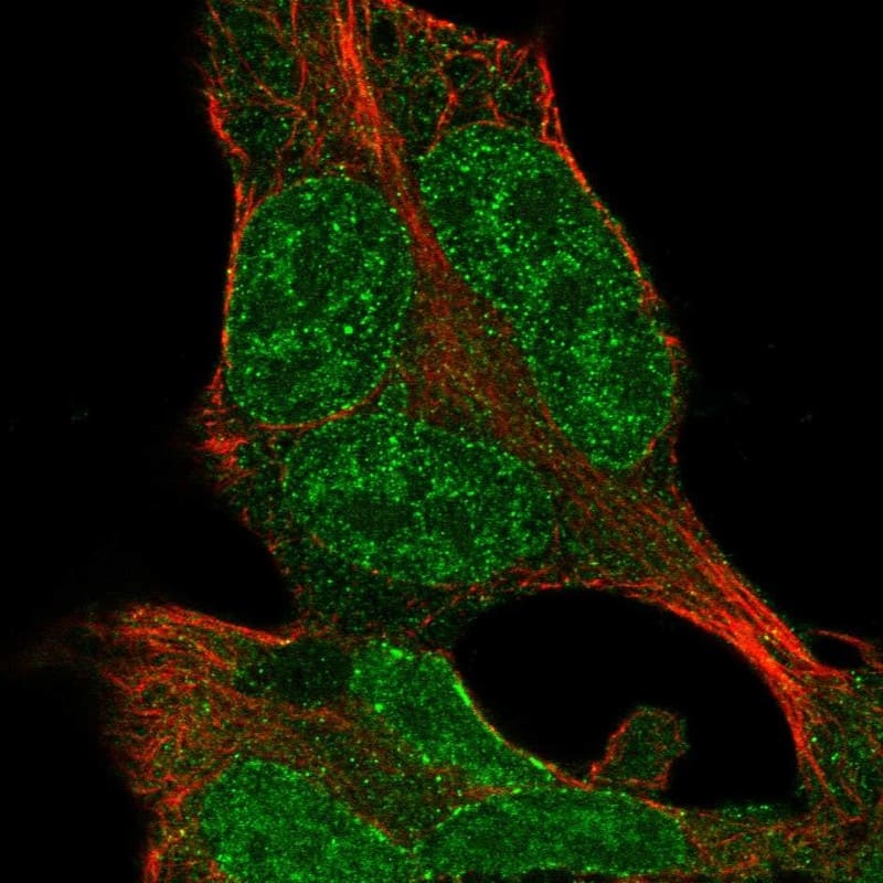 ZNF398 Antibody Immunocytochemistry/Immunofluorescence: ZNF398 Antibody [NBP3-24876]