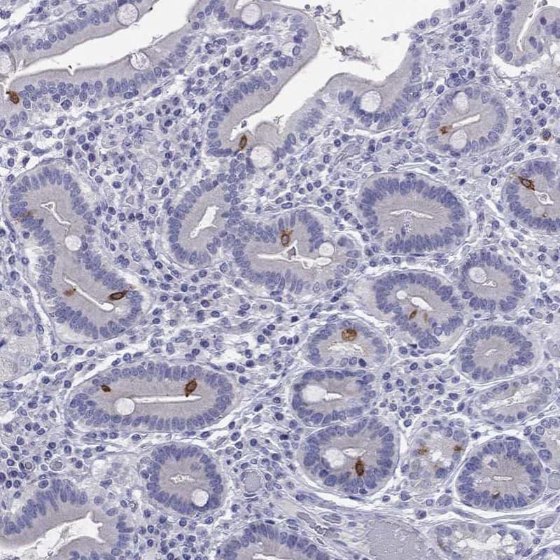 GNAT3 Antibody Immunohistochemistry-Paraffin: GNAT3 Antibody [NBP3-24879]