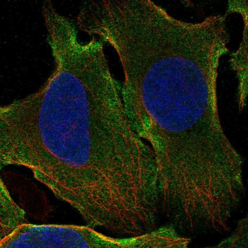 GPATCH1 Antibody Immunocytochemistry/Immunofluorescence: GPATCH1 Antibody [NBP3-24881]