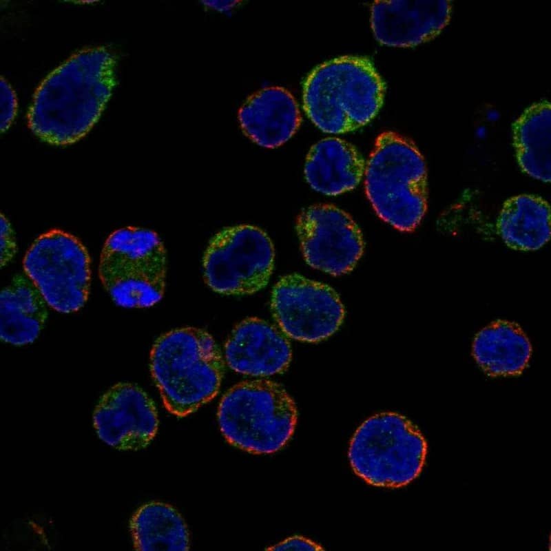 GRK2 Antibody Immunocytochemistry/Immunofluorescence: GRK2 Antibody [NBP3-24887]