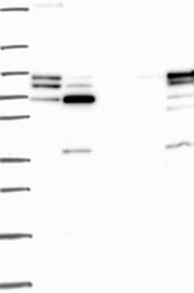 GRK2 Antibody Western Blot: GRK2 Antibody [NBP3-24887]