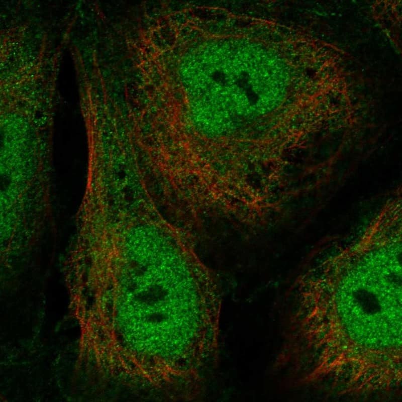 GTF2A1L Antibody Immunocytochemistry/Immunofluorescence: GTF2A1L Antibody [NBP3-24888]