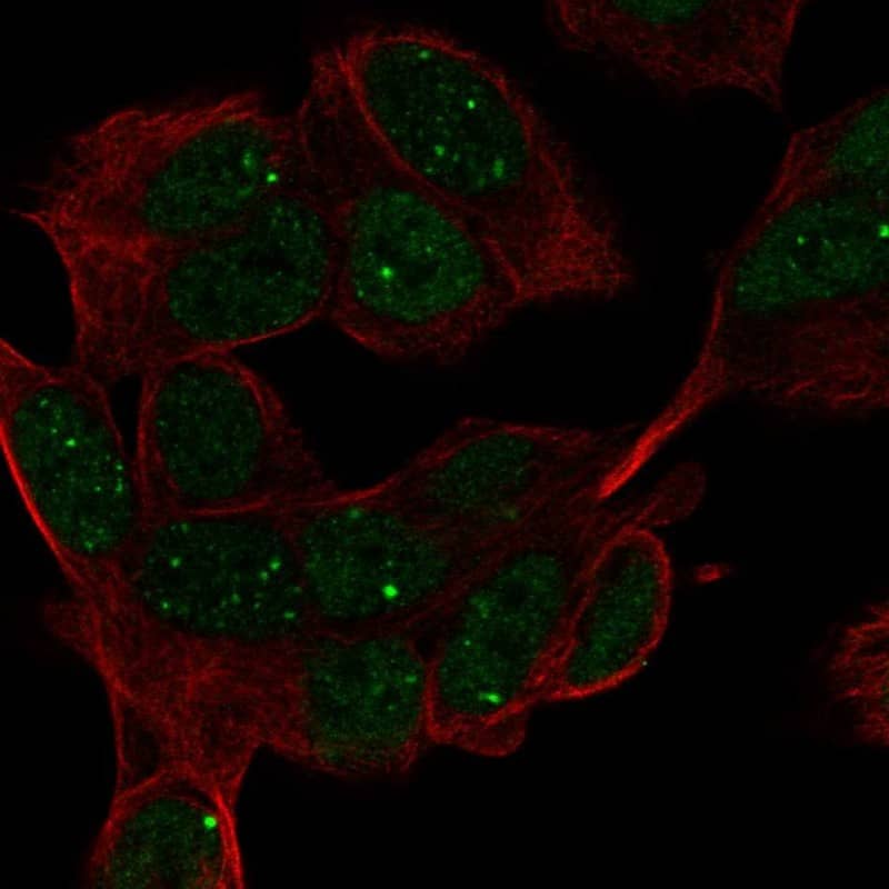 HAND1 Antibody Immunocytochemistry/Immunofluorescence: HAND1 Antibody [NBP3-24890]