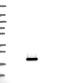 Haptoglobin Antibody Western Blot: Haptoglobin Antibody [NBP3-24891]