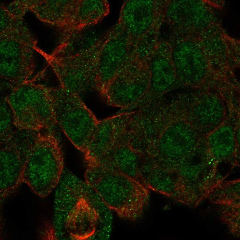 HDAC10 Antibody Immunocytochemistry/Immunofluorescence: HDAC10 Antibody [NBP3-24894]
