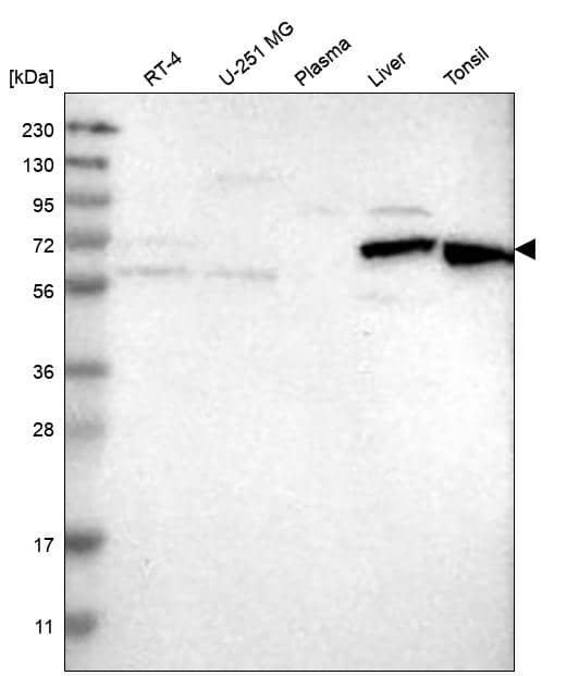 HDAC10 Antibody Western Blot: HDAC10 Antibody [NBP3-24894]