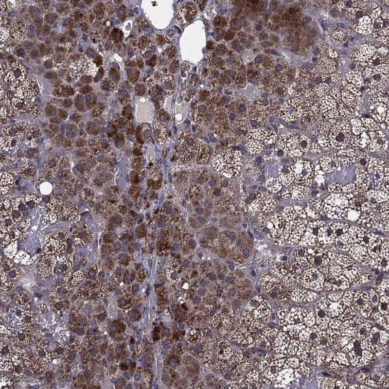 HDAC5 Antibody Immunohistochemistry-Paraffin: HDAC5 Antibody [NBP3-24895]