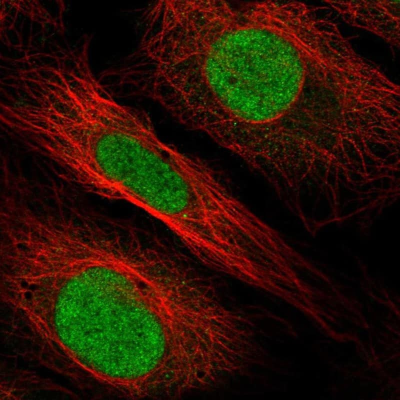 HOXB1 Antibody Immunocytochemistry/Immunofluorescence: HOXB1 Antibody [NBP3-24901]