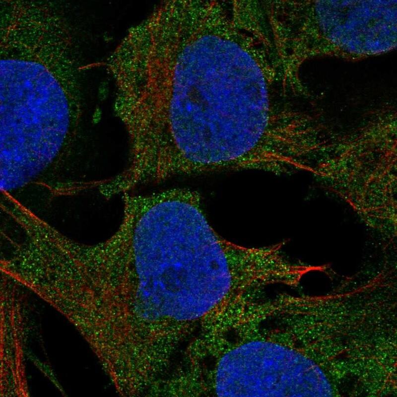 HRASLS5 Antibody Immunocytochemistry/Immunofluorescence: HRASLS5 Antibody [NBP3-24902]