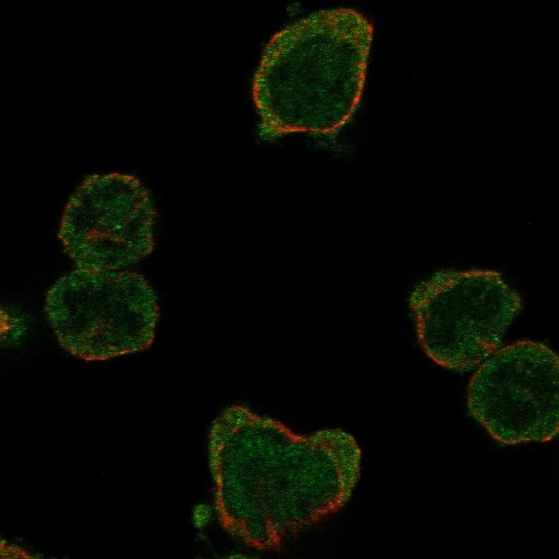 HSFY1 Antibody Immunocytochemistry/Immunofluorescence: HSFY1 Antibody [NBP3-24903]