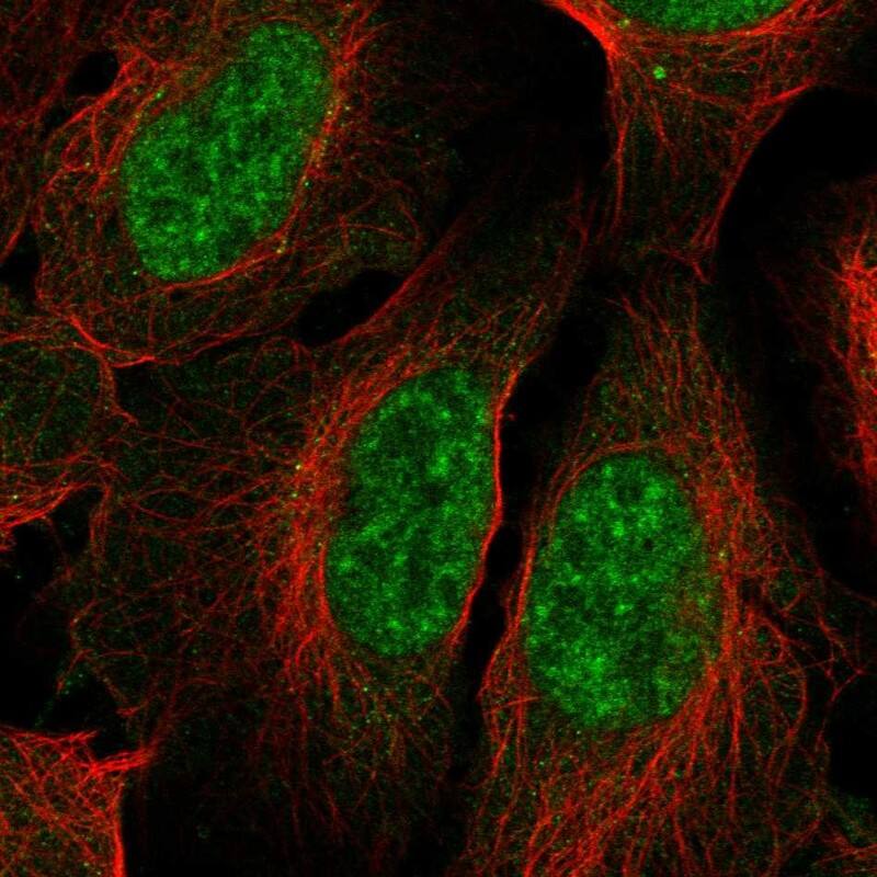 HspB9 Antibody Immunocytochemistry/Immunofluorescence: HspB9 Antibody [NBP3-24904]