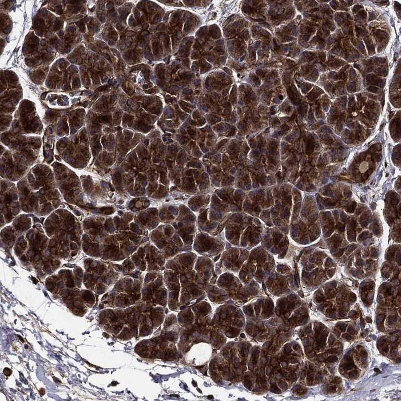 Huntingtin Antibody Immunohistochemistry-Paraffin: Huntingtin Antibody [NBP3-24905]