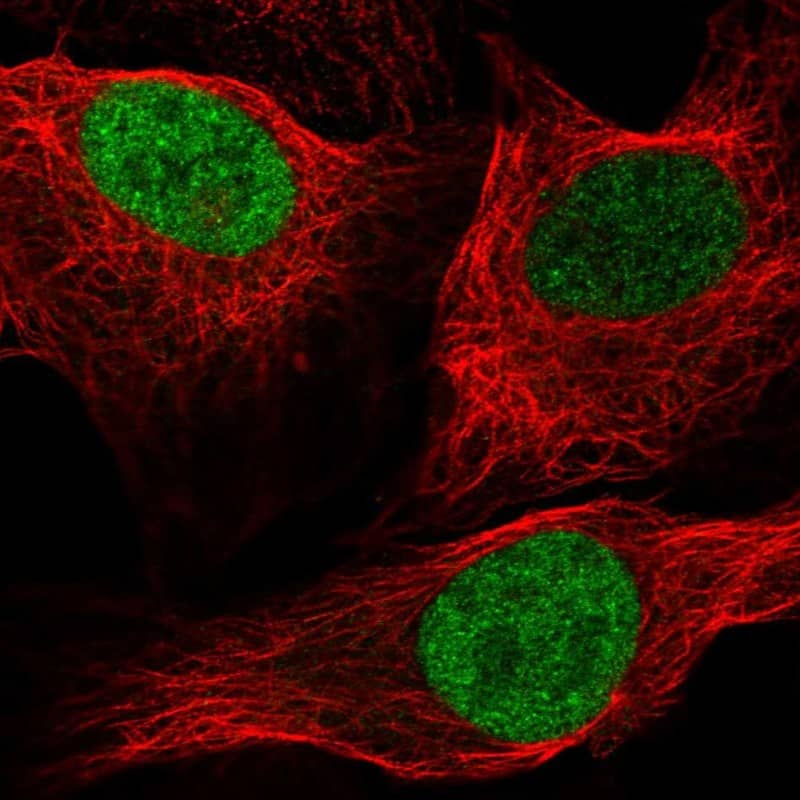 ID1 Antibody Immunocytochemistry/Immunofluorescence: ID1 Antibody [NBP3-24907]