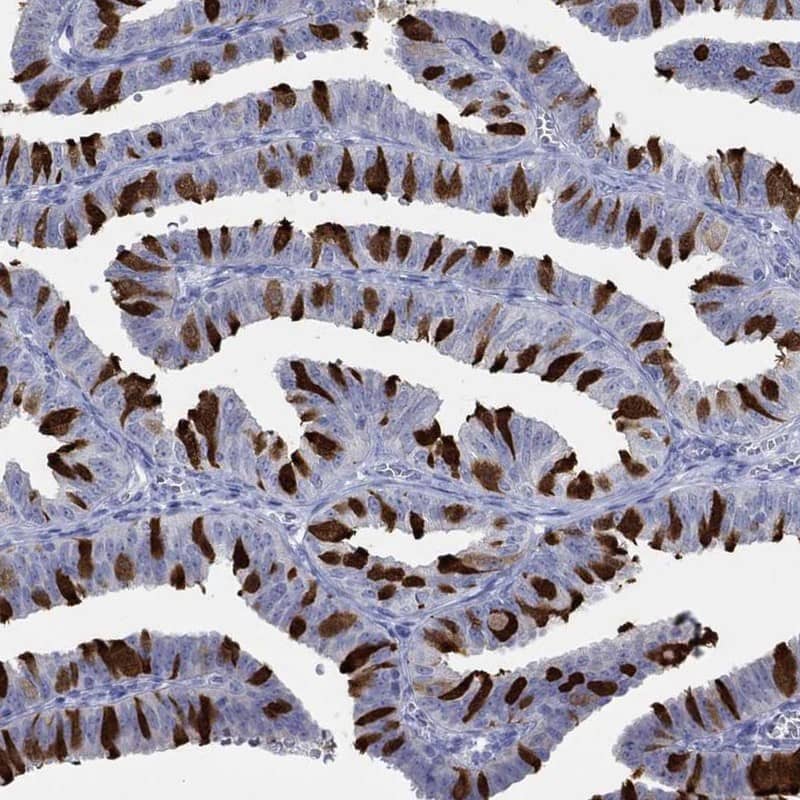 IGFBP-6 Antibody Immunohistochemistry-Paraffin: IGFBP-6 Antibody [NBP3-24909]