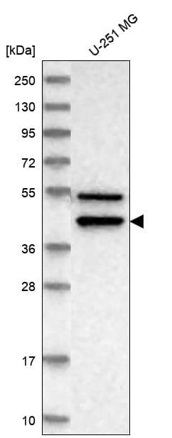 IL-11R alpha Antibody Western Blot: IL-11R alpha Antibody [NBP3-24911]