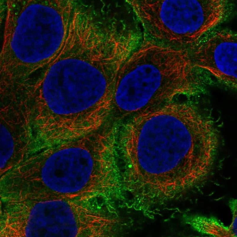 IL-36 gamma/IL-1F9 Antibody Immunocytochemistry/Immunofluorescence: IL-36 gamma/IL-1F9 Antibody [NBP3-24913]