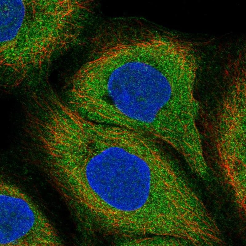 ILT5/CD85a/LILRB3 Antibody Immunocytochemistry/Immunofluorescence: ILT5/CD85a/LILRB3 Antibody [NBP3-24915]