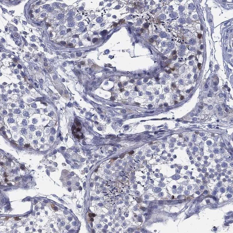 IMP5 Antibody Immunohistochemistry-Paraffin: IMP5 Antibody [NBP3-24916]