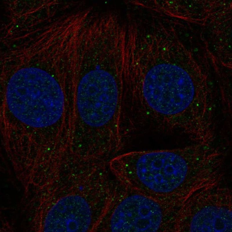 Activin B/Inhibin beta B Antibody Immunocytochemistry/Immunofluorescence: Activin B/Inhibin beta B Antibody [NBP3-24918]