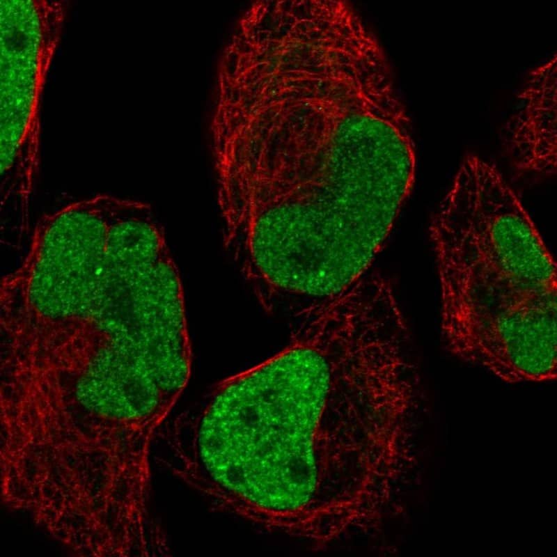 INSIGF Antibody Immunocytochemistry/Immunofluorescence: INSIGF Antibody [NBP3-24920]