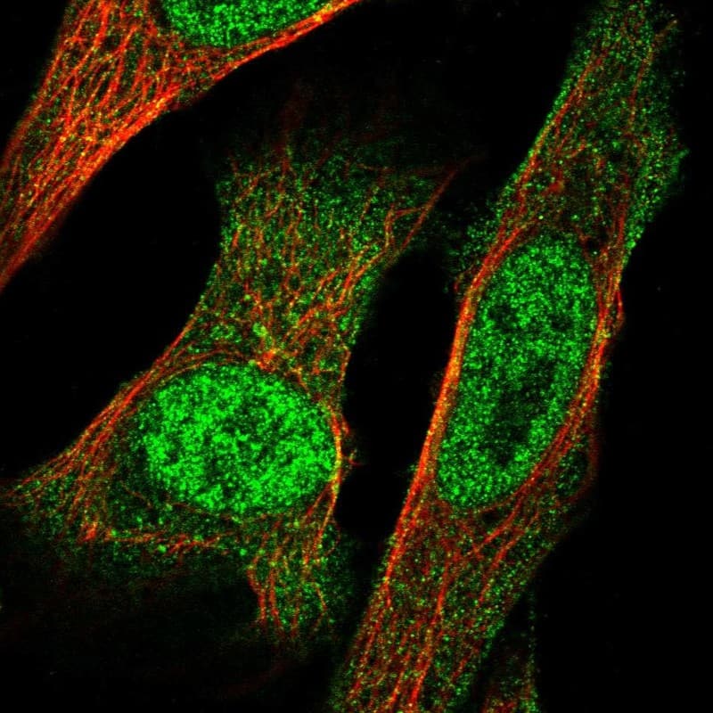 IRX3 Antibody Immunocytochemistry/Immunofluorescence: IRX3 Antibody [NBP3-24923]