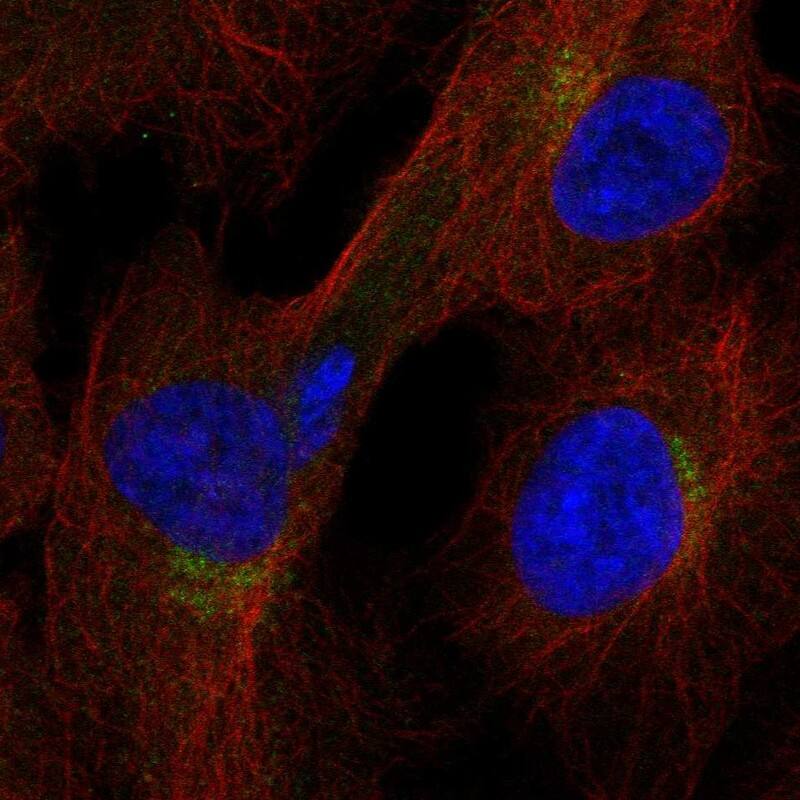 ITFG1 Antibody Immunocytochemistry/Immunofluorescence: ITFG1 Antibody [NBP3-24924]