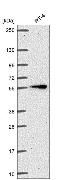 ITK Antibody Western Blot: ITK Antibody [NBP3-24925]