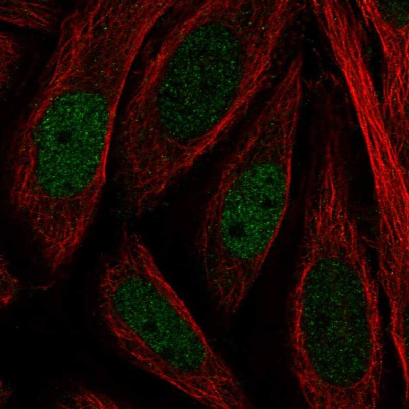 JMJD2B Antibody Immunocytochemistry/Immunofluorescence: JMJD2B Antibody [NBP3-24926]