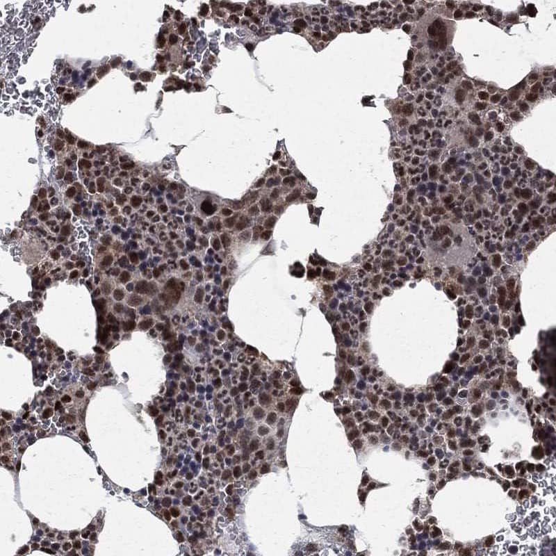 JMJD6/PSR Antibody Immunohistochemistry-Paraffin: JMJD6/PSR Antibody [NBP3-24927]