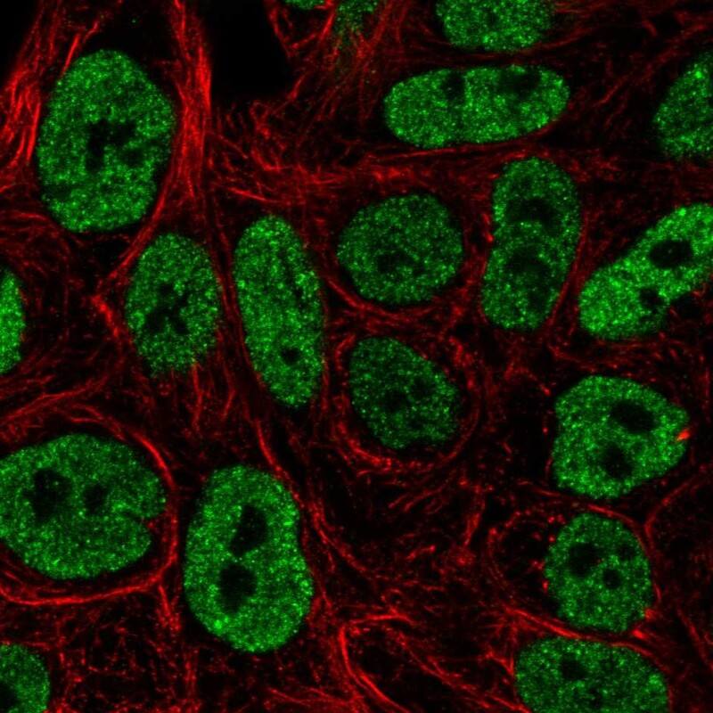 JNK3 Antibody Immunocytochemistry/Immunofluorescence: JNK3 Antibody [NBP3-24929]