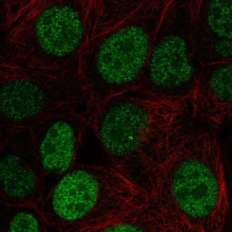 JunD Antibody Immunocytochemistry/Immunofluorescence: JunD Antibody [NBP3-24931]