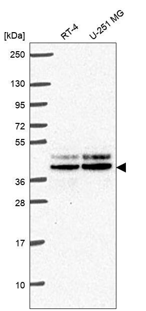 JunD Antibody Western Blot: JunD Antibody [NBP3-24931]