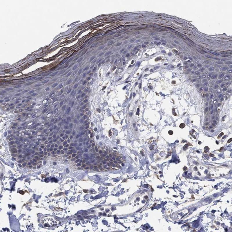 Kallikrein 5 Antibody Immunohistochemistry-Paraffin: Kallikrein 5 Antibody [NBP3-24933]