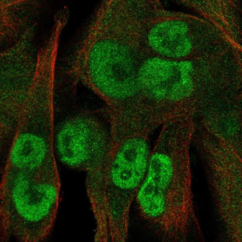 KCTD15 Antibody Immunocytochemistry/Immunofluorescence: KCTD15 Antibody [NBP3-24936]