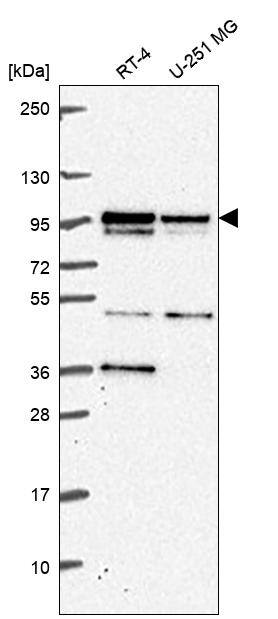 KIF3B Antibody Western Blot: KIF3B Antibody [NBP3-24939]