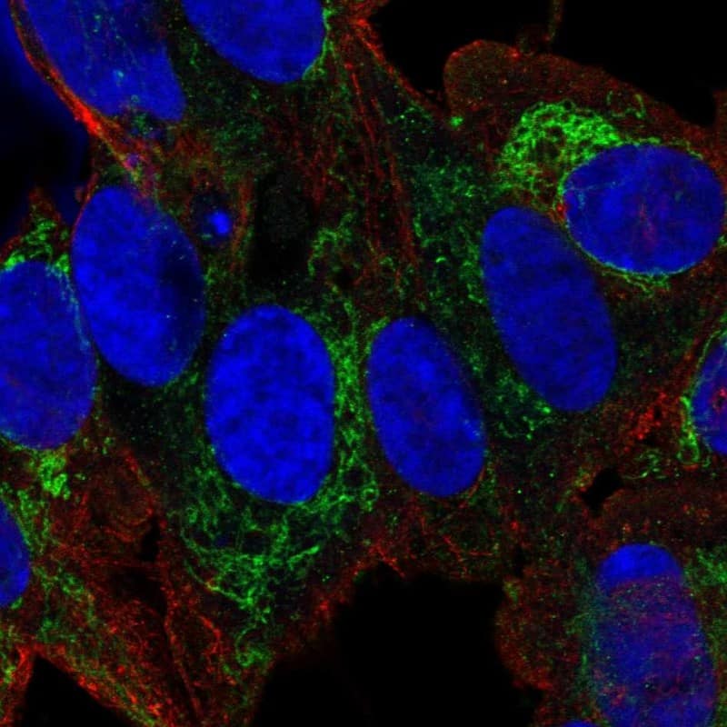 Kir3.1 Antibody Immunocytochemistry/Immunofluorescence: Kir3.1 Antibody [NBP3-24940]